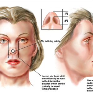 Rhinoplasty Chevy Chase