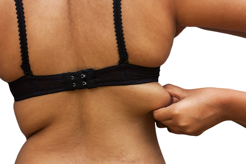 Battling with Bra Bulge: What You Can Do About Back Fat?