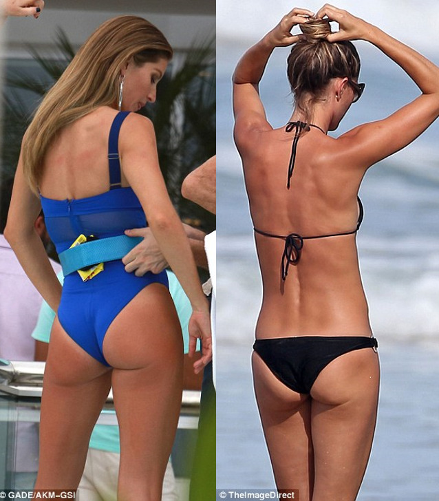 Brazilian Butt Lift