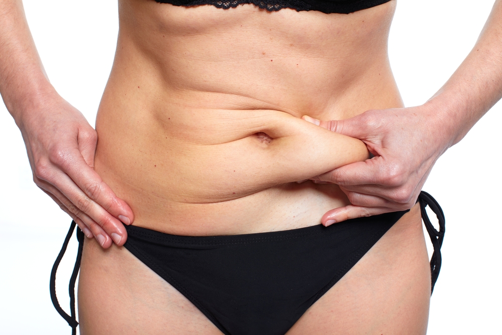 Liposuction or CoolSculpting