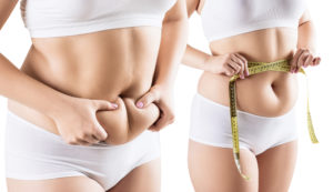 Liposuction Facts