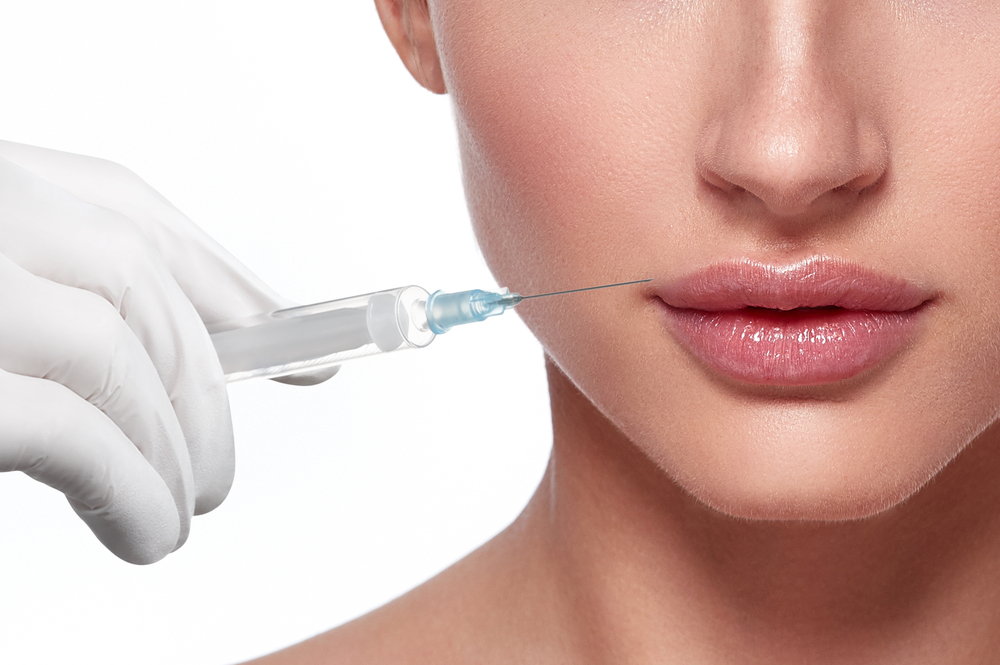 Lip Filler Injections McLean