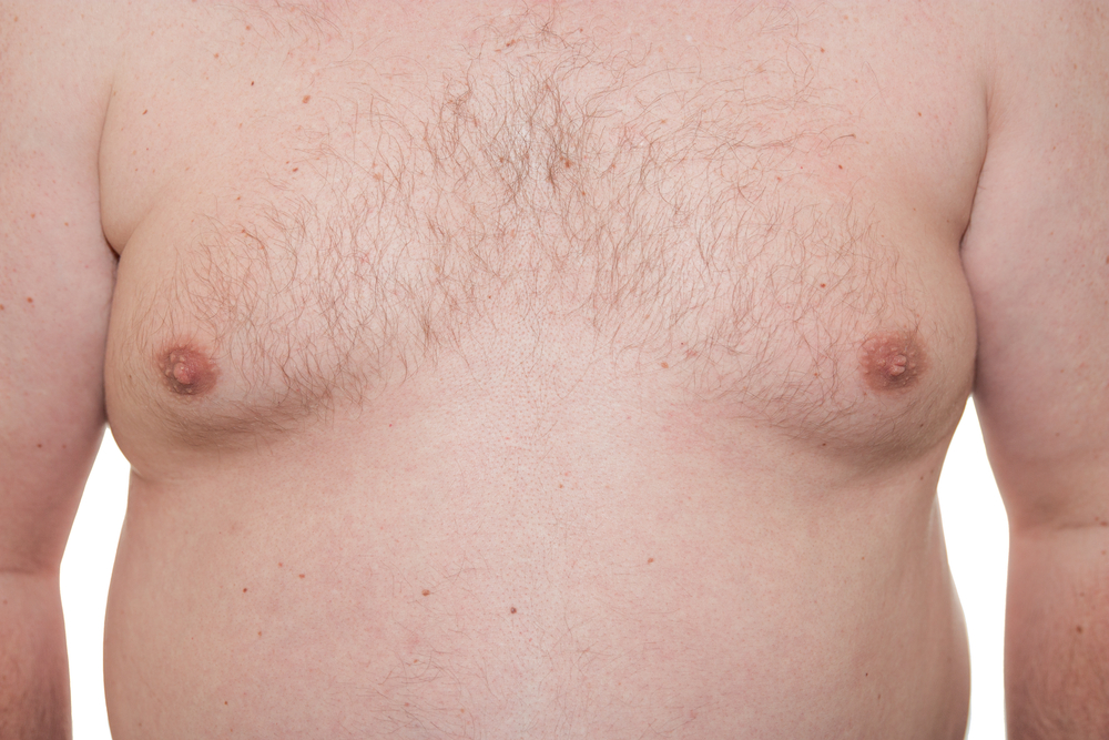 Teenage boy who had B-cup breasts - PHOTO