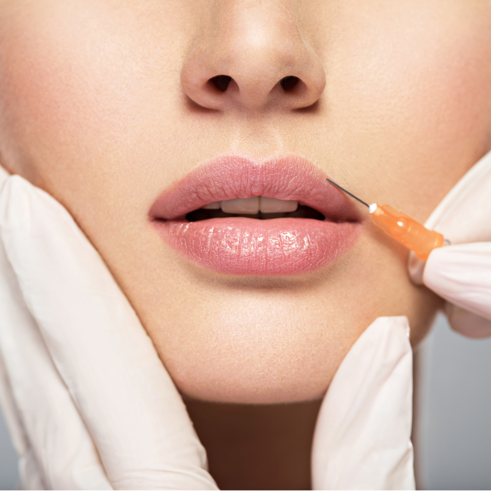 The Modern Guide to Botox and Fillers
