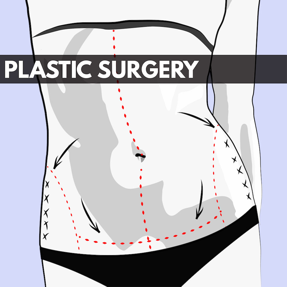 ALL ABOUT SURGICAL GARMENTS — Eterno 360°, Plastic Surgery & Cosmetic  Treatments