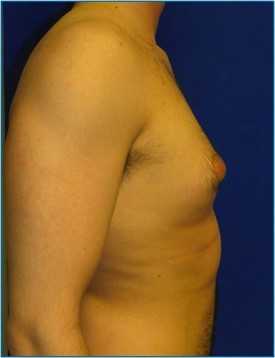 43654022-b737-45af-a562-f6d32faad5b2_lg