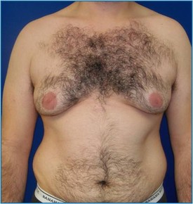 8d83329e-9b8c-49e6-9b11-c6f0ed3003df_lg