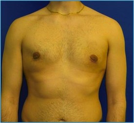 f925f6f1-0818-4437-ae18-858bc5adafc7_lg