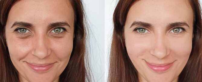 plastic surgeon in McLean, VA